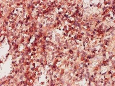Immunohistochemistry-Paraffin: Ketohexokinase Antibody (1H6-2B6) [H00003795-M01]