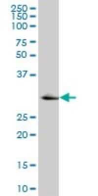 Western Blot: Ketohexokinase Antibody (2B1) [H00003795-M07]
