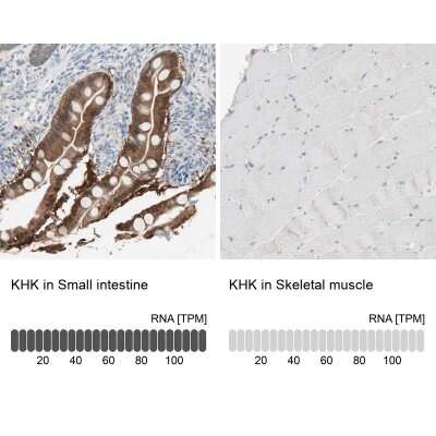 Immunohistochemistry-Paraffin: Ketohexokinase Antibody [NBP1-85790]