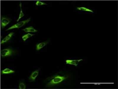 Immunocytochemistry/ Immunofluorescence: Ketohexokinase Antibody (S1) [H00003795-M03]