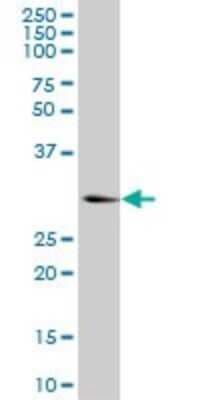 Western Blot: Ketohexokinase Antibody (S1) [H00003795-M03]