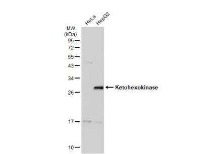 Western Blot: Ketohexokinase Antibody [NBP1-32778]
