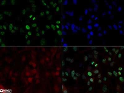 Immunocytochemistry/ Immunofluorescence: Ki67/MKI67 Antibody (8D5) - BSA Free [NBP2-22112]