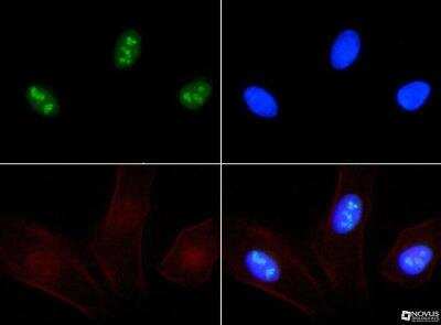Immunocytochemistry/ Immunofluorescence: Ki67/MKI67 Antibody [DyLight 594] [NB500-170DL594]