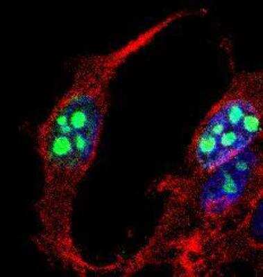 Immunocytochemistry/ Immunofluorescence: Ki67/MKI67 Antibody [DyLight 594] [NB500-170DL594]