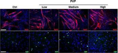Immunocytochemistry/ Immunofluorescence: Ki67/MKI67 Antibody - BSA Free [NB110-89717]
