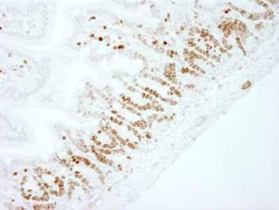 Immunohistochemistry: Ki67/MKI67 Antibody - BSA Free [NB110-89717]
