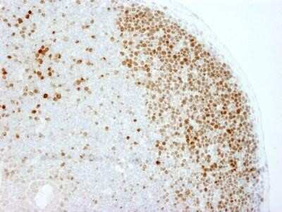 Immunohistochemistry: Ki67/MKI67 Antibody - BSA Free [NB110-89717]