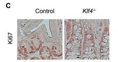 Immunohistochemistry: Ki67/MKI67 Antibody - BSA Free [NB110-89717]