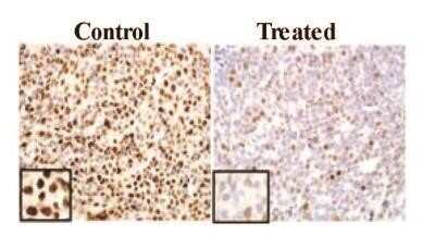 Immunohistochemistry-Paraffin: Ki67/MKI67 Antibody - BSA Free [NB110-89717]