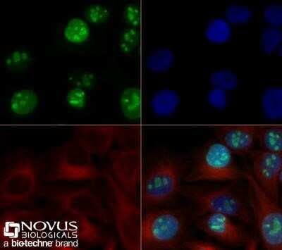 Immunocytochemistry/ Immunofluorescence: Ki67/MKI67 Antibody (1297A) - Azide and BSA Free [NBP2-80822]