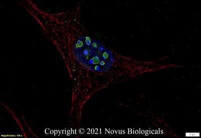 Immunocytochemistry/ Immunofluorescence: Ki67/MKI67 Antibody (1297A) - Azide and BSA Free [NBP2-80822]
