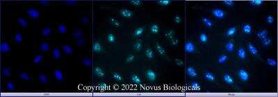 Immunocytochemistry/ Immunofluorescence: Ki67/MKI67 Antibody (1297A) - BSA Free [NBP2-54791]