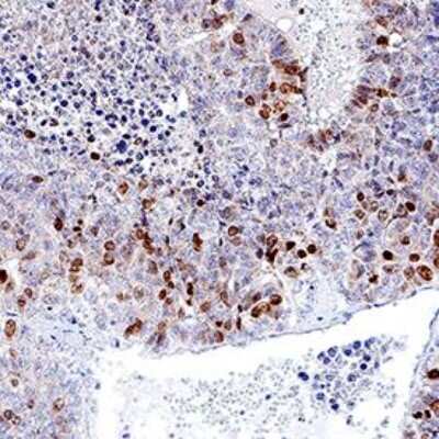Immunohistochemistry-Paraffin: Ki67/MKI67 Antibody (1297A) - BSA Free [NBP2-54791]