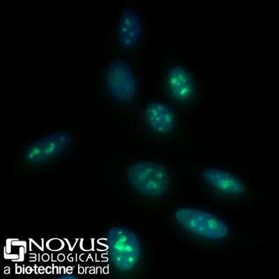 Immunocytochemistry/ Immunofluorescence: Ki67/MKI67 Antibody (8D5) - Azide and BSA Free [NBP2-80821]