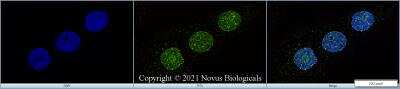Immunocytochemistry/ Immunofluorescence: Ki67/MKI67 Antibody (8D5) - Azide and BSA Free [NBP2-80821]