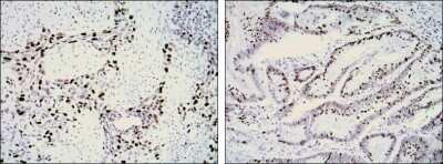 Immunohistochemistry-Paraffin: Ki67/MKI67 Antibody (8D5) - Azide and BSA Free [NBP2-80821]