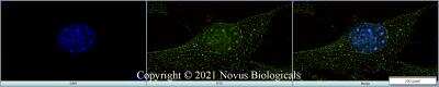 Immunocytochemistry/ Immunofluorescence: Ki67/MKI67 Antibody (8D5) - BSA Free [NBP2-22112]