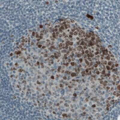 Immunohistochemistry-Paraffin: Ki67/MKI67 Antibody (CL1234) [NBP2-76476]