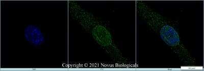 Immunocytochemistry/ Immunofluorescence: Ki67/MKI67 Antibody - BSA Free [NB110-90592]