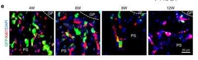 Immunohistochemistry: Ki67/MKI67 Antibody - BSA Free [NB500-170]
