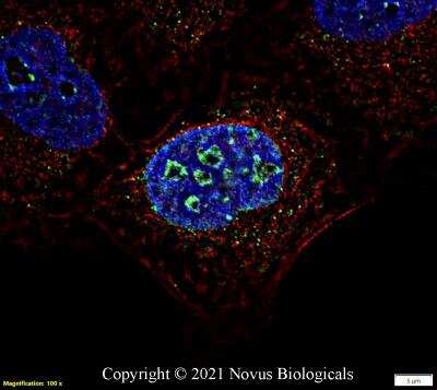 Immunocytochemistry/ Immunofluorescence: Ki67/MKI67 Antibody - BSA Free [NB500-170]