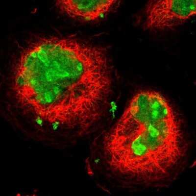 Immunocytochemistry/ Immunofluorescence: Ki67/MKI67 Antibody [NBP2-54656]