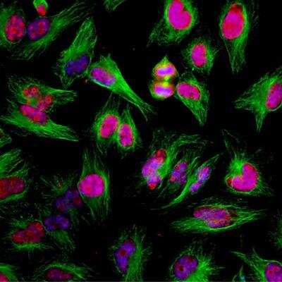 Immunocytochemistry/ Immunofluorescence: Ki67/MKI67 Antibody [NBP3-05538]