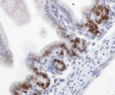 Immunohistochemistry: Ki67/MKI67 Antibody - BSA Free [NB110-89719]