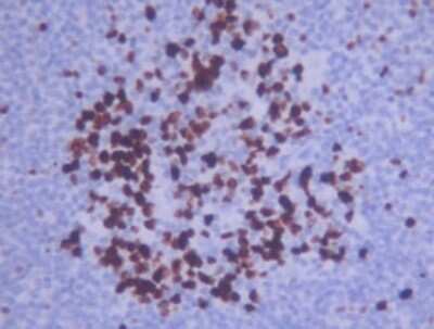 Immunohistochemistry: Ki67/MKI67 Antibody - BSA Free [NB110-90592]