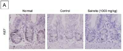 Immunohistochemistry-Paraffin: Ki67/MKI67 Antibody - BSA Free [NB110-89719]