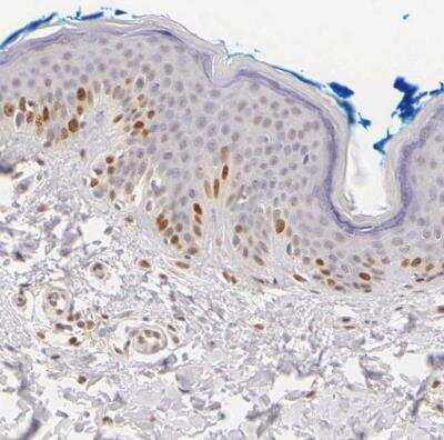 Immunohistochemistry-Paraffin: Ki67/MKI67 Antibody [NBP2-54656]