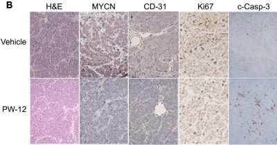 Immunohistochemistry: Ki67/MKI67 Antibody (SP6) - Unpurified [NB600-1252]