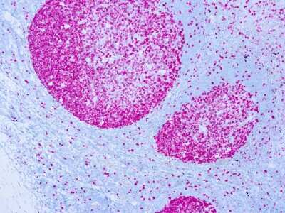 Immunohistochemistry-Paraffin: Ki67/MKI67 Antibody (SP6) - Unpurified [NB600-1252]