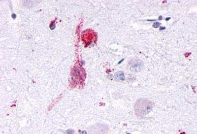 Immunohistochemistry-Paraffin: KiSS1R/GPR54 Antibody - BSA Free [NLS1927]