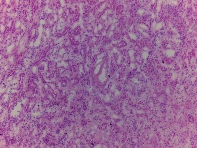 Hematoxylin & Eosin Stain: Kidney Tissue Slides (Adult Normal)- Frozen [NBP2-77572]