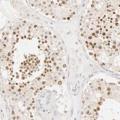 Immunohistochemistry-Paraffin: Kif2a Antibody [NBP1-83253]