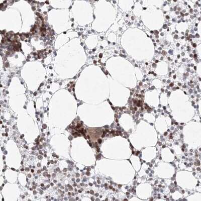 Immunohistochemistry-Paraffin: Kif4A Antibody [NBP1-83720]