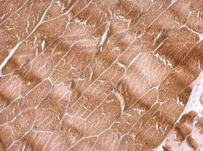 Immunohistochemistry-Paraffin: Kilon/NEGR1 Antibody [NBP1-32529]