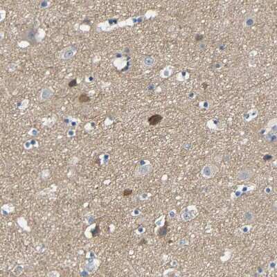 Immunohistochemistry-Paraffin: Kilon/NEGR1 Antibody [NBP1-83116]