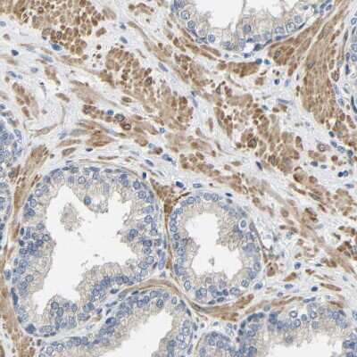 Immunohistochemistry-Paraffin: Kilon/NEGR1 Antibody [NBP1-83116]
