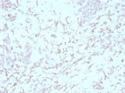 Immunohistochemistry-Paraffin: Kindlin Antibody (4A5.14) [NBP3-07696]
