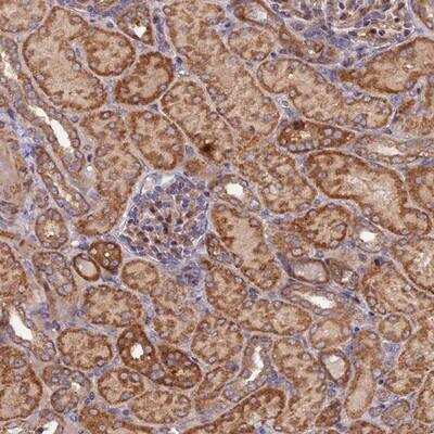Immunohistochemistry: Kindlin Antibody [NBP1-89884]