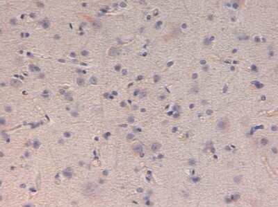 Immunohistochemistry: Kinesin 5B Antibody [NBP2-21667]