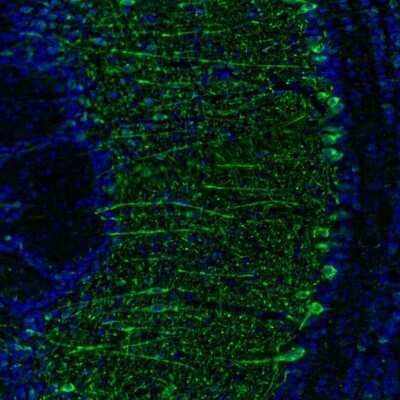 Immunohistochemistry: Kinesin 5A Antibody [NBP1-85344]