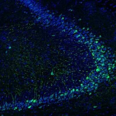 Immunohistochemistry: Kinesin 5A Antibody [NBP1-85344]