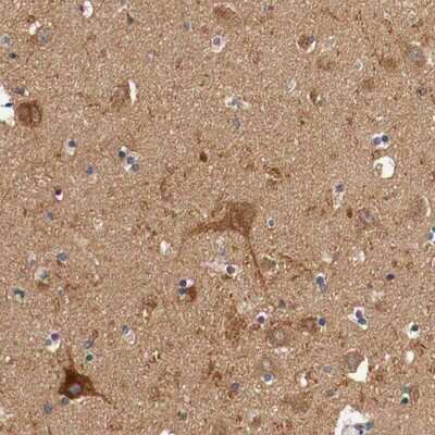 Immunohistochemistry-Paraffin: Kinesin 5A Antibody [NBP1-85344]
