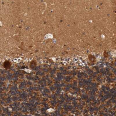 Immunohistochemistry-Paraffin: Kinesin 5A Antibody [NBP1-85344]