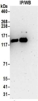 Immunoprecipitation: Kinesin 5A Antibody [NBP2-32231]
