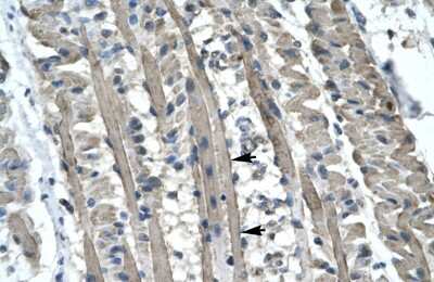 Immunohistochemistry-Paraffin: Kinesin 5B Antibody [NBP1-58118]